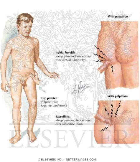 Watermarked preview of labeled image: Physical Exam of the Pelvis