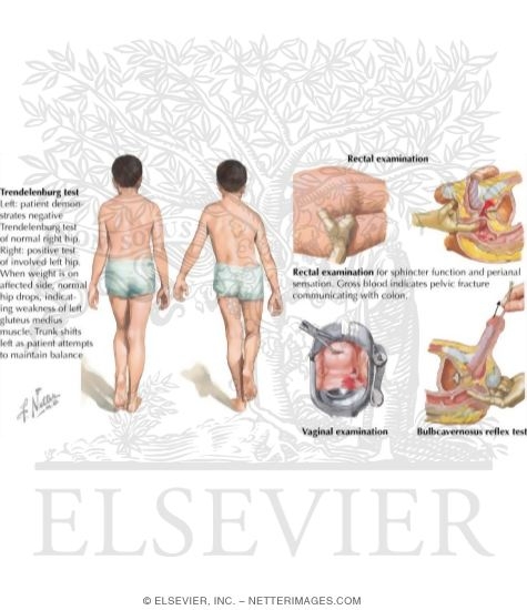 Watermarked preview of labeled image: Physical Examination of the Pelvis