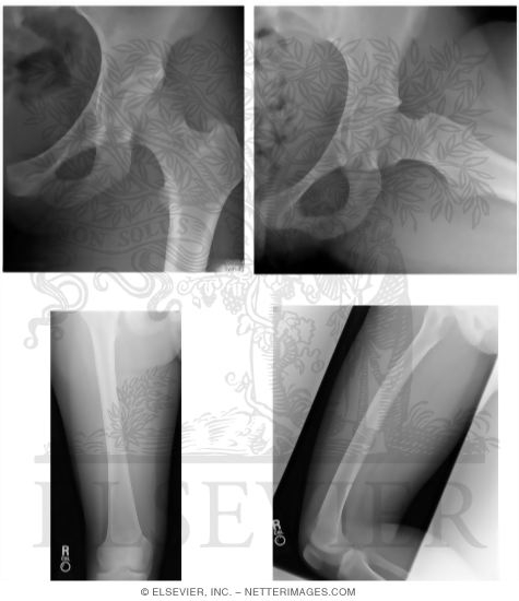 Watermarked preview of unlabeled image: Radiology of the Thigh and Hip