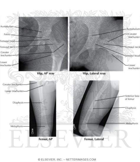 Watermarked preview of labeled image: Radiology of the Thigh and Hip