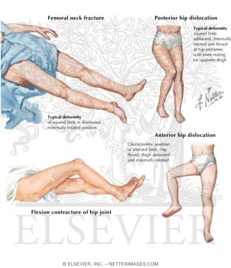 Physical Examination of the Thigh and Hip