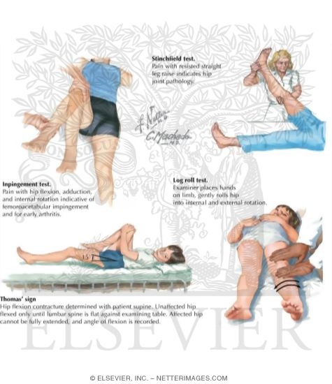 Watermarked preview of labeled image: Physical Examination of the Thigh and Hip