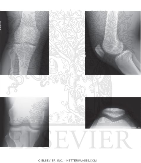 Watermarked preview of unlabeled image: Radiology of the Leg and Knee