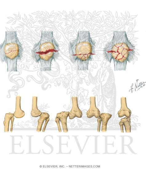 Watermarked preview of unlabeled image: Trauma of the Leg and Knee