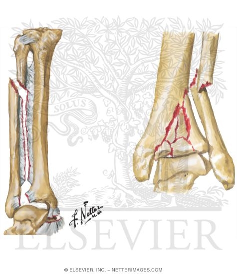 Watermarked preview of unlabeled image: Trauma of the Leg and Knee