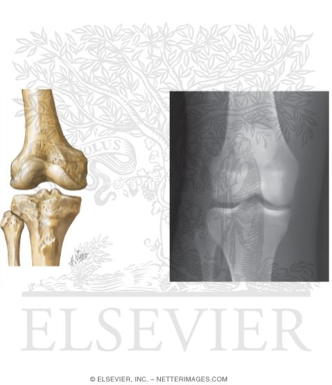 Watermarked preview of unlabeled image: Joints of the Leg and Knee