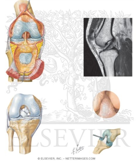 Watermarked preview of unlabeled image: Joints of the Leg and Knee