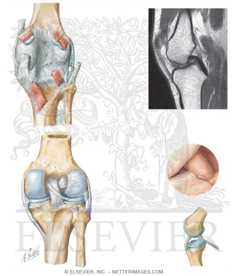 Watermarked preview of unlabeled image: Joints of the Leg and Knee