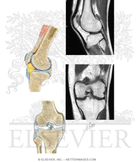 Watermarked preview of unlabeled image: Joints of the Leg and Knee
