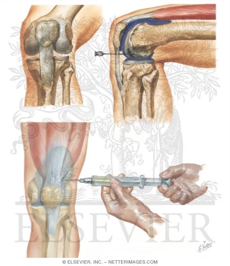 Watermarked preview of unlabeled image: Minor Procedures of the Leg and Knee