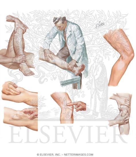 Watermarked preview of unlabeled image: Physical Examination of the Leg and Knee