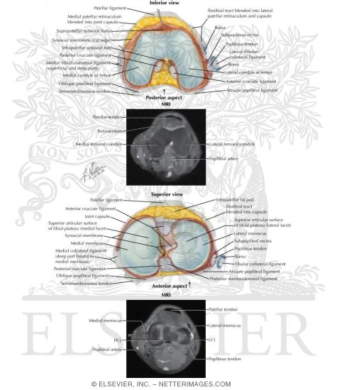 Watermarked preview of labeled image: Knee Joints