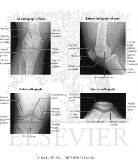 Watermarked preview of labeled image: Radiology of the Leg and Knee
