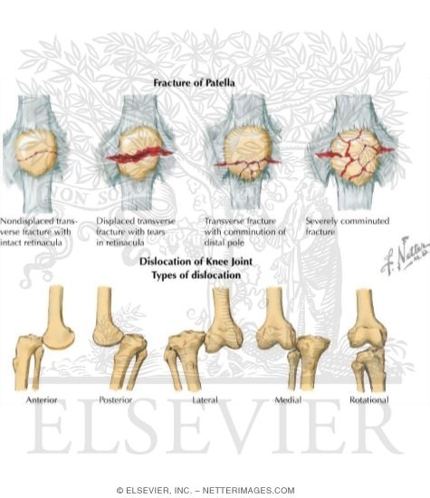 Watermarked preview of labeled image: Trauma of the Leg and Knee