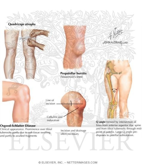 Watermarked preview of labeled image: Physical Examination of the Leg and Knee