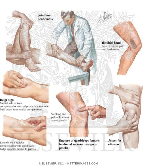 Physical Examination of the Leg and Knee