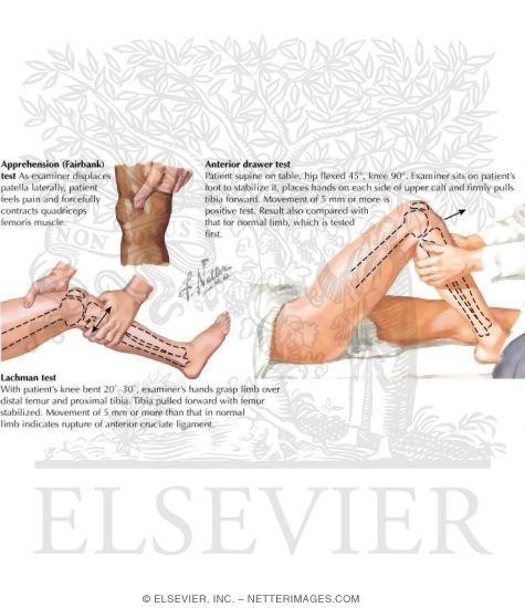 Watermarked preview of labeled image: Physical Examination of the Leg and Knee