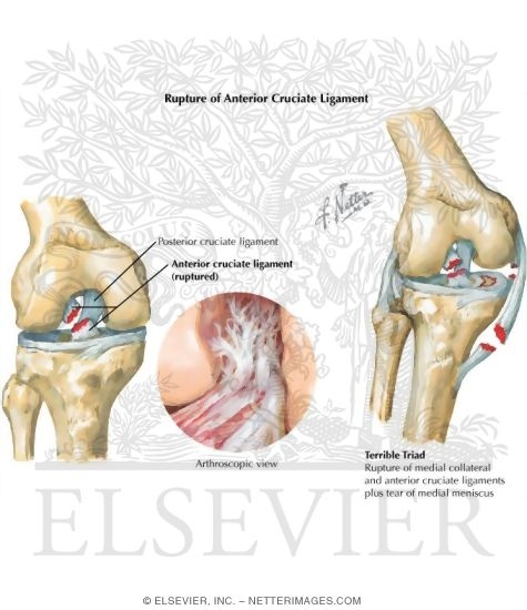 Watermarked preview of labeled image: Disorders of the Leg and Knee