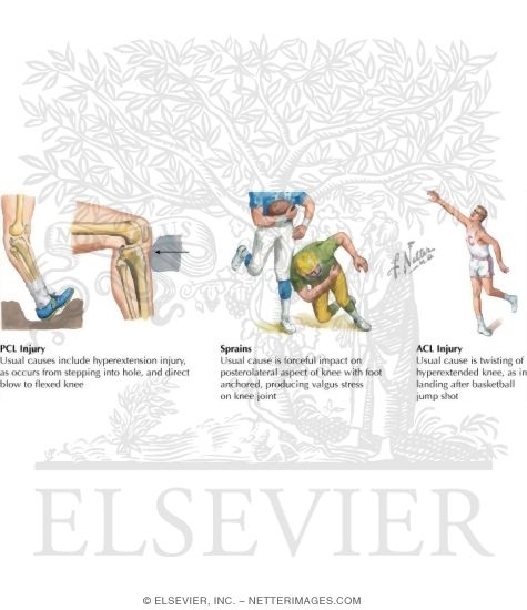 Medical History of the Leg and Knee