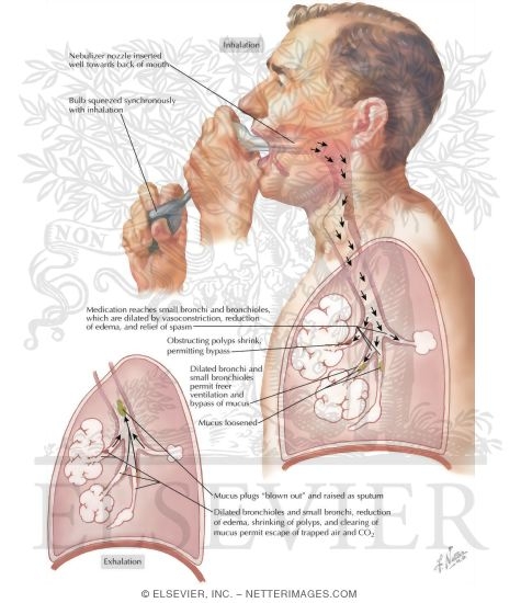 Watermarked preview of labeled image: Use Of Hand Nebulizer