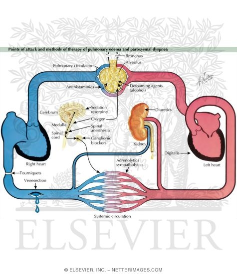Treatment of Pulmonary Edema and Paroxysmal Dyspnea