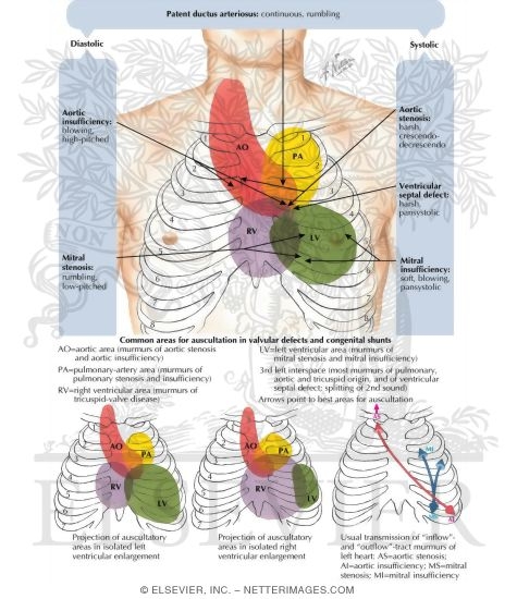 Watermarked preview of labeled image: Areas of Cardiac Auscultation 