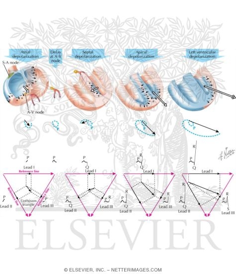 Watermarked preview of labeled image: Progression of Depolarization 