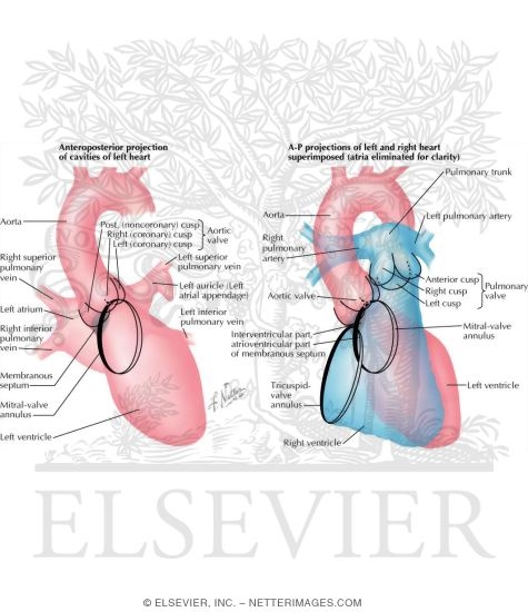Watermarked preview of labeled image: Radiology and Angiocardiography