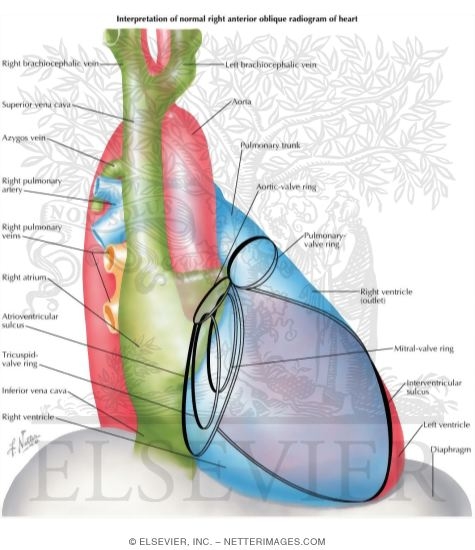 Watermarked preview of labeled image: Radiology and Angiocardiography