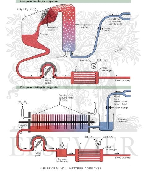 Extracorporeal Circulation