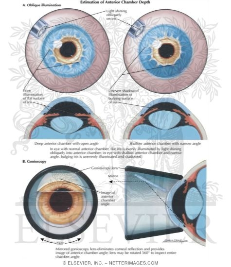 Estimation of Anterior Chamber Depth