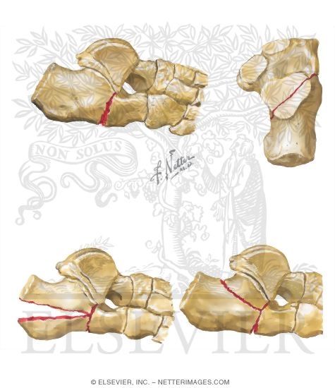 Watermarked preview of unlabeled image: Trauma of the Foot and Ankle