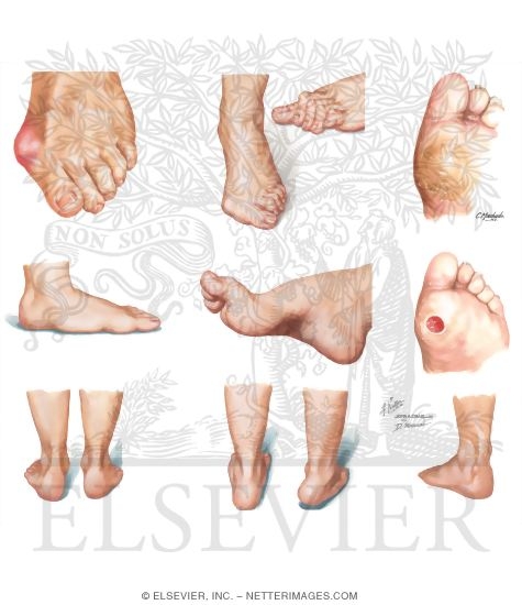 Watermarked preview of unlabeled image: Physical Examination of the Foot and Ankle