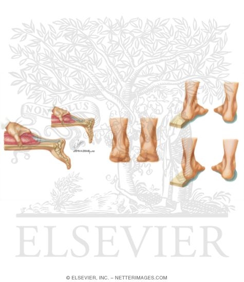 Watermarked preview of unlabeled image: Physical Examination of the Foot and Ankle