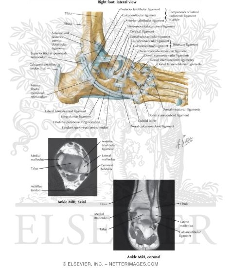 Watermarked preview of labeled image: Lateral Ligaments of Ankle