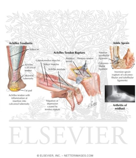Watermarked preview of labeled image: Disorders of the Foot and Ankle