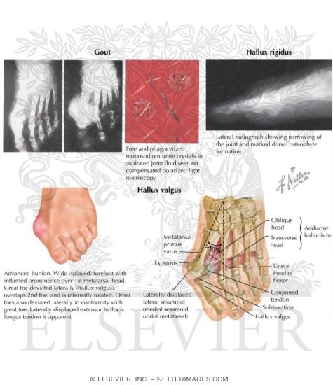 Watermarked preview of labeled image: Disorders of the Foot and Ankle
