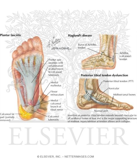 Watermarked preview of labeled image: Disorders of the Foot and Ankle