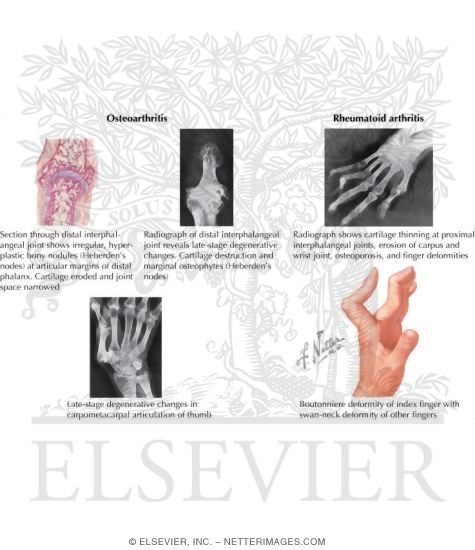 Watermarked preview of labeled image: Disorders of the Hand