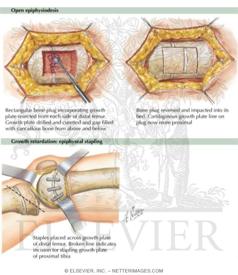 Watermarked preview of labeled image: Growth Arrest