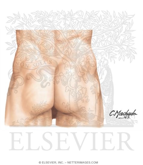 Watermarked preview of unlabeled image: Pelvis and Perineum: Surface Anatomy