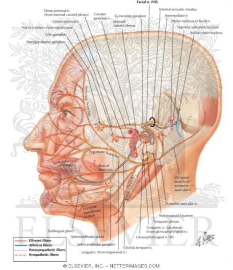 Watermarked preview of labeled image: Facial nerve (VII)