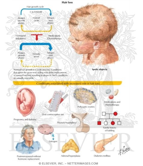 Watermarked preview of labeled image: Hair Loss