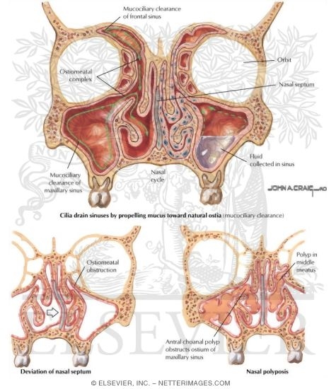 Watermarked preview of labeled image: Histology and Physiology of Nasal Cavity and Sinuses