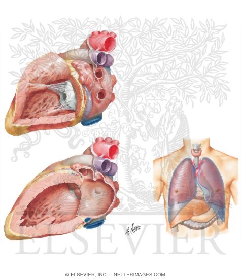 Watermarked preview of unlabeled image: Left Atrium and Ventricle 