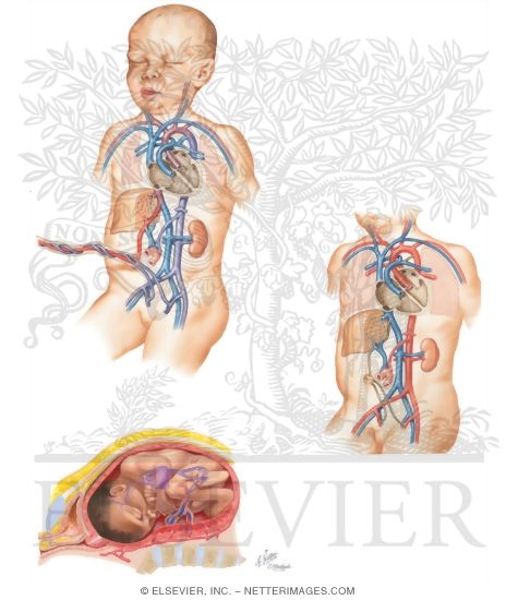 Watermarked preview of unlabeled image: Fetal Circulation Pattern and Changes at Birth