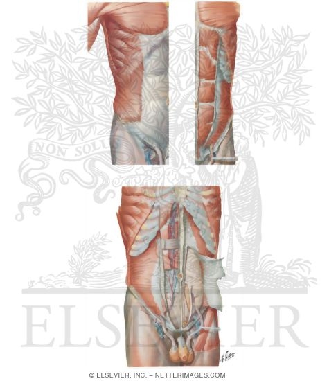 Muscles of the Anterolateral Abdominal Wall