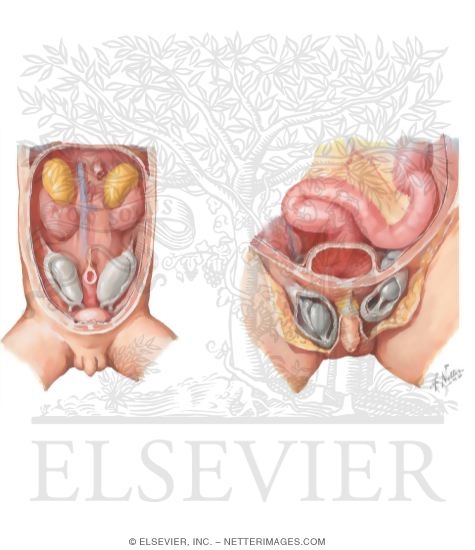 Watermarked preview of unlabeled image: Fetal Descent of the Testis