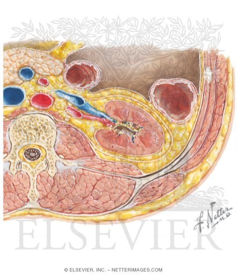 Watermarked preview of unlabeled image: Renal Fascia and Fat