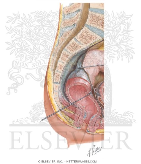 Watermarked preview of unlabeled image: Rectum and Anal Canal